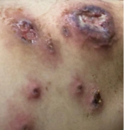 J Skin Stem Cell
